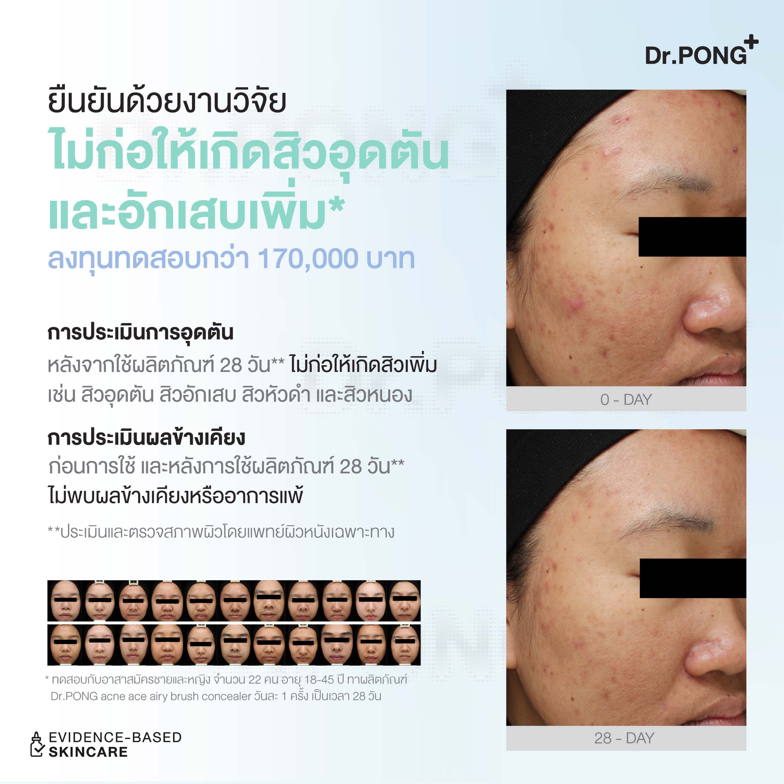 [บุฟเฟต์] Dr.PONG ACNE ACE AIRY BRUSH CONCEALER