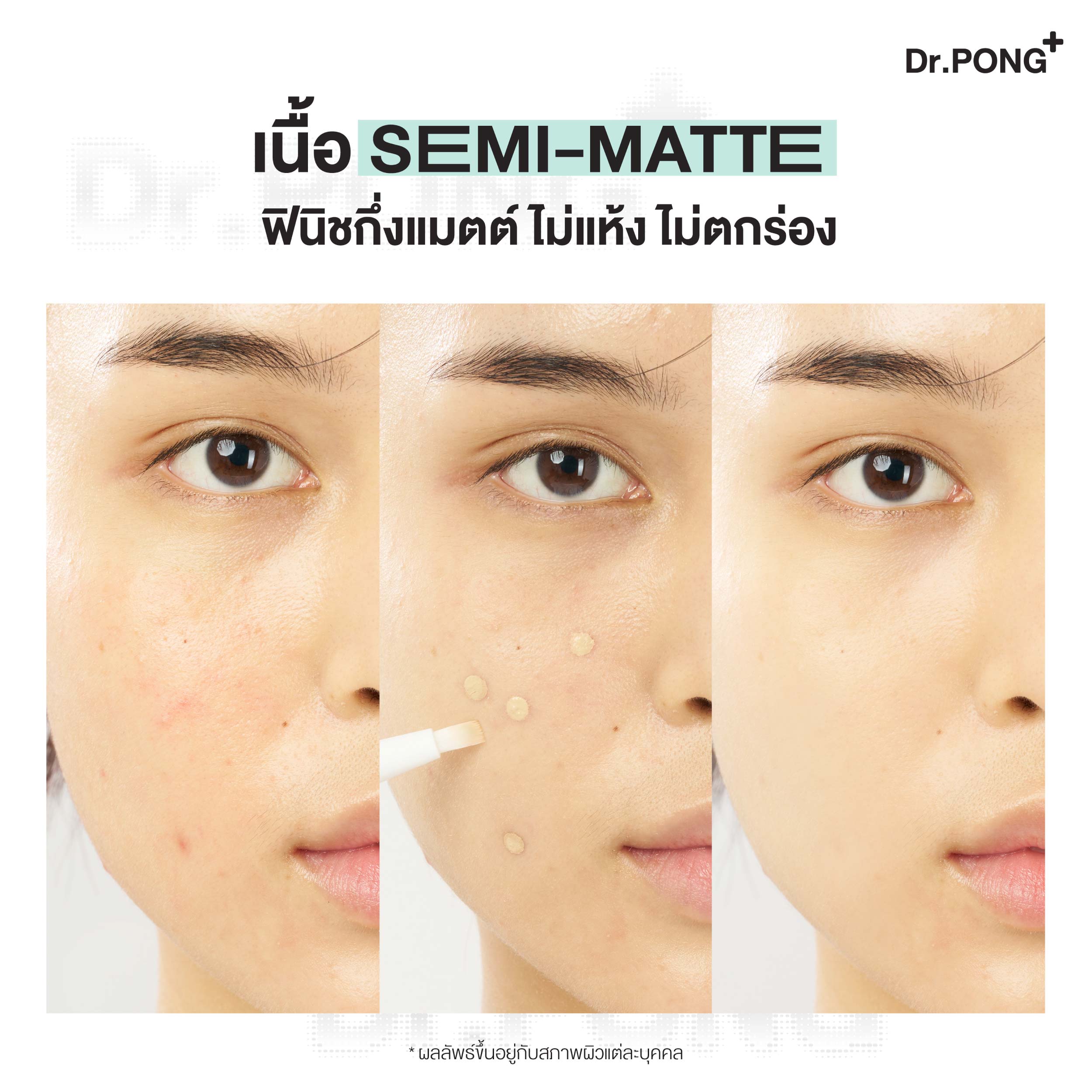 [บุฟเฟต์] Dr.PONG ACNE ACE AIRY BRUSH CONCEALER