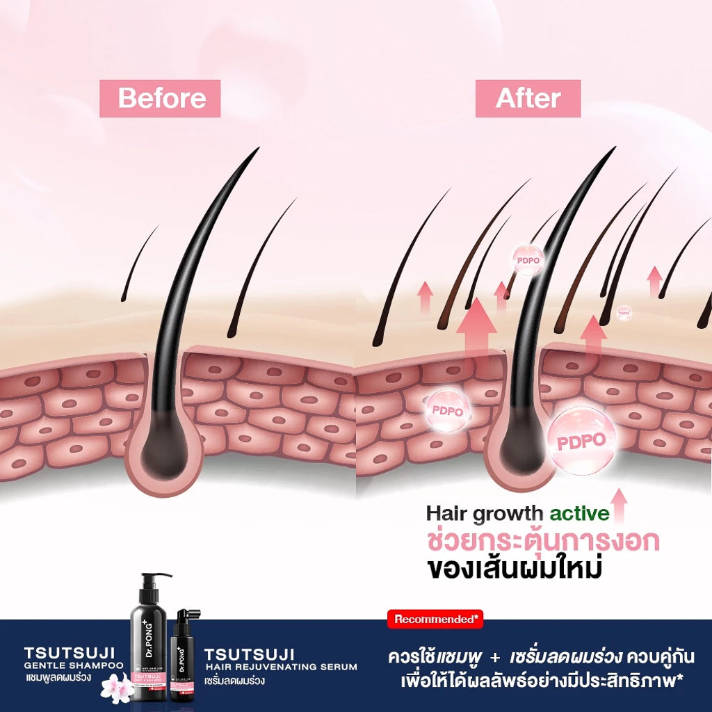 Dr.PONG TSUTSUJI HAIR REJUVENATING SERUM ANTI-HAIR LOSS